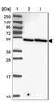 Zinc Finger Protein 3 antibody, NBP2-13545, Novus Biologicals, Western Blot image 