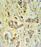 Fibrinogen Beta Chain antibody, 62-294, ProSci, Immunohistochemistry paraffin image 