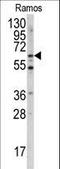 Menin 1 antibody, LS-C100612, Lifespan Biosciences, Western Blot image 