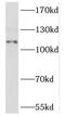 Atrial natriuretic peptide receptor 2 antibody, FNab05823, FineTest, Western Blot image 