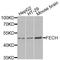 Ferrochelatase, mitochondrial antibody, A05156, Boster Biological Technology, Western Blot image 