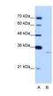 Exosome Component 6 antibody, NBP1-57471, Novus Biologicals, Western Blot image 