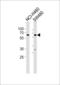Protein Phosphatase 2 Scaffold Subunit Abeta antibody, OAAB18901, Aviva Systems Biology, Western Blot image 