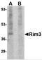 Regulating Synaptic Membrane Exocytosis 3 antibody, 4471, ProSci, Western Blot image 