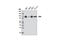ERCC Excision Repair 3, TFIIH Core Complex Helicase Subunit antibody, 8746S, Cell Signaling Technology, Western Blot image 