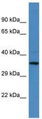 PBIP1 antibody, TA342608, Origene, Western Blot image 