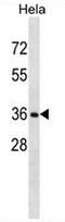 Ring Finger Protein 34 antibody, AP53691PU-N, Origene, Western Blot image 