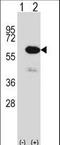 Methionyl Aminopeptidase 2 antibody, LS-C164150, Lifespan Biosciences, Western Blot image 