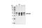 Mitogen-Activated Protein Kinase 8 antibody, 9258P, Cell Signaling Technology, Western Blot image 