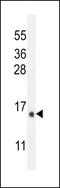 Radiation-inducible immediate-early gene IEX-1 antibody, LS-C165117, Lifespan Biosciences, Western Blot image 