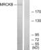 CDC42 Binding Protein Kinase Beta antibody, abx013872, Abbexa, Western Blot image 