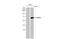 Glutamate Decarboxylase 2 antibody, GTX636487, GeneTex, Western Blot image 