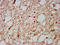 Homeobox D1 antibody, LS-C674125, Lifespan Biosciences, Immunohistochemistry paraffin image 