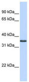 COP9 Signalosome Subunit 5 antibody, TA329313, Origene, Western Blot image 