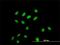 Chromodomain Y-like protein antibody, H00009425-M02, Novus Biologicals, Immunocytochemistry image 