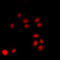 CDKN2A antibody, LS-C351999, Lifespan Biosciences, Immunofluorescence image 