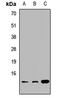 CDGSH Iron Sulfur Domain 1 antibody, LS-C668360, Lifespan Biosciences, Western Blot image 