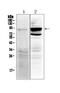 Toll Like Receptor 2 antibody, A00131, Boster Biological Technology, Western Blot image 