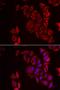 Recoverin antibody, orb247415, Biorbyt, Immunofluorescence image 