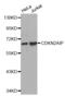 CDKN2A Interacting Protein antibody, abx002319, Abbexa, Western Blot image 