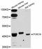 Porcupine O-Acyltransferase antibody, A12250, ABclonal Technology, Western Blot image 