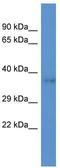 DnaJ Heat Shock Protein Family (Hsp40) Member C22 antibody, TA338689, Origene, Western Blot image 