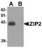 Solute Carrier Family 39 Member 2 antibody, LS-C115933, Lifespan Biosciences, Western Blot image 