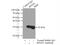 Ribosomal Protein S4 X-Linked antibody, 14799-1-AP, Proteintech Group, Immunoprecipitation image 