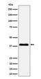 NAD(P) Dependent Steroid Dehydrogenase-Like antibody, M04902, Boster Biological Technology, Western Blot image 