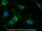Tenascin C antibody, NB110-68136, Novus Biologicals, Immunocytochemistry image 