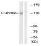 Spectrin Repeat Containing Nuclear Envelope Family Member 3 antibody, AP33271PU-N, Origene, Western Blot image 