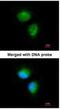 Metabolism Of Cobalamin Associated C antibody, NBP1-32513, Novus Biologicals, Immunofluorescence image 