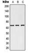 Selectin E antibody, LS-C353794, Lifespan Biosciences, Western Blot image 
