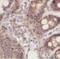 Gelsolin antibody, FNab03417, FineTest, Immunohistochemistry paraffin image 
