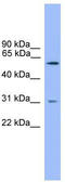 Neuroendocrine convertase 2 antibody, TA342649, Origene, Western Blot image 