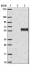 Keratocan antibody, NBP1-84425, Novus Biologicals, Western Blot image 