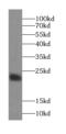 Signal Sequence Receptor Subunit 2 antibody, FNab08943, FineTest, Western Blot image 