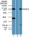 Histone Deacetylase 9 antibody, PA5-23346, Invitrogen Antibodies, Western Blot image 