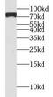 PID antibody, FNab05388, FineTest, Western Blot image 