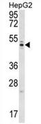 WD Repeat Domain 12 antibody, AP54534PU-N, Origene, Western Blot image 