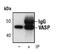 Vasodilator Stimulated Phosphoprotein antibody, MA5-14982, Invitrogen Antibodies, Immunoprecipitation image 