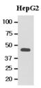 Methionine Adenosyltransferase 2A antibody, GTX50027, GeneTex, Western Blot image 