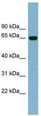 Interleukin 22 Receptor Subunit Alpha 1 antibody, TA338469, Origene, Western Blot image 