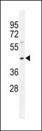 Monoacylglycerol O-Acyltransferase 3 antibody, PA5-48315, Invitrogen Antibodies, Western Blot image 