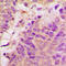Protein Tyrosine Kinase 2 antibody, LS-C358851, Lifespan Biosciences, Immunohistochemistry frozen image 
