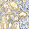 Dihydropyrimidine dehydrogenase [NADP+] antibody, A1620, ABclonal Technology, Immunohistochemistry paraffin image 