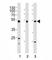 Hnf3b antibody, F52908-0.4ML, NSJ Bioreagents, Western Blot image 