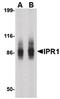 SP110 Nuclear Body Protein antibody, PA5-20461, Invitrogen Antibodies, Western Blot image 