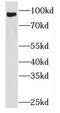 Phospholipase A2 Group IVD antibody, FNab06505, FineTest, Western Blot image 