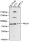 Prospero homeobox protein 1 antibody, 14-761, ProSci, Western Blot image 